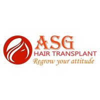 Best Hair Transplant In Punjab | ASG Hair Transplant Centre